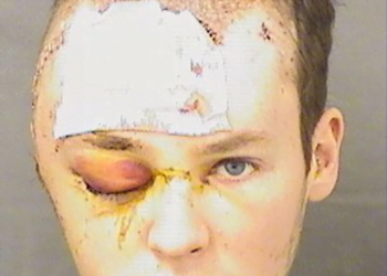 Social Worker Abducted & Tortured For 15 Hours In Man’s Home