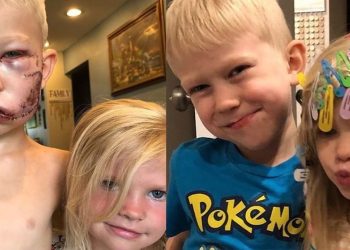 Two Brothers Save Younger Sister From Savage Dog Attack